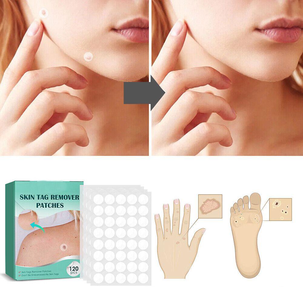 SkinClear - Patch for removing spots and warts