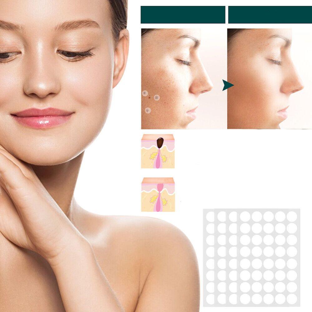 SkinClear - Patch for removing spots and warts