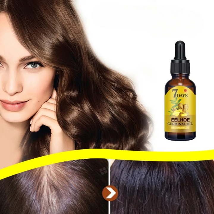 Ginger Hair Growth Natural Treatment for Hair Loss