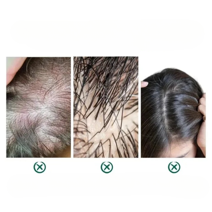 Vegan Lavender Essential Hair Oil Repairs damaged hair
